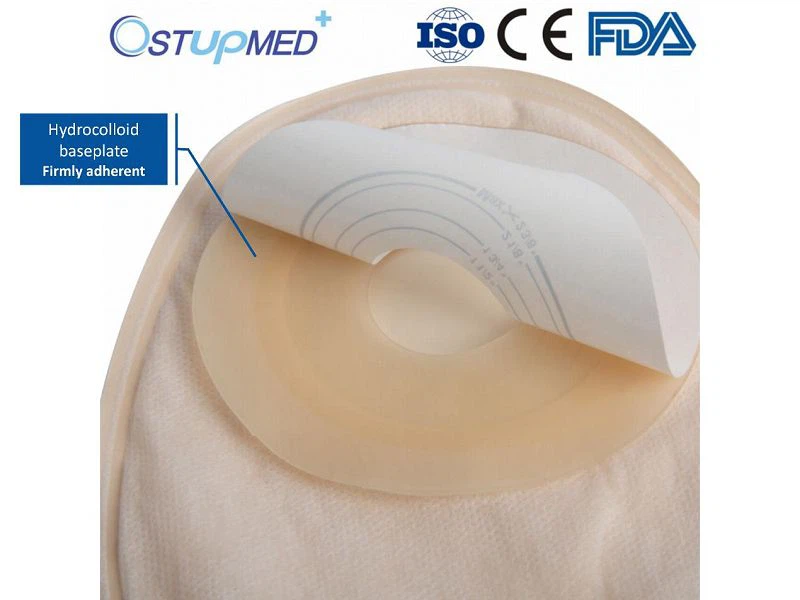 Temporary Colostomy Bag
